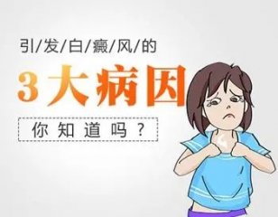 白癜风治疗费用